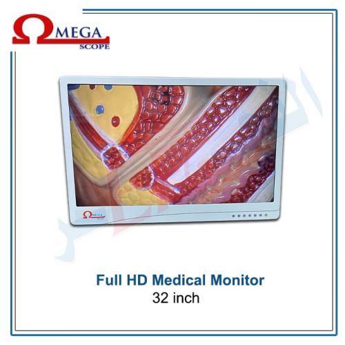 FHD Medical Monitor 32 inch - شاشة طبية 32 انش ماركة اوميجا 
