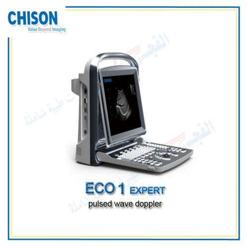  CHISON Eco 1 expert جهاز سونار تشيزون إيكو 1 اكسبرت 
