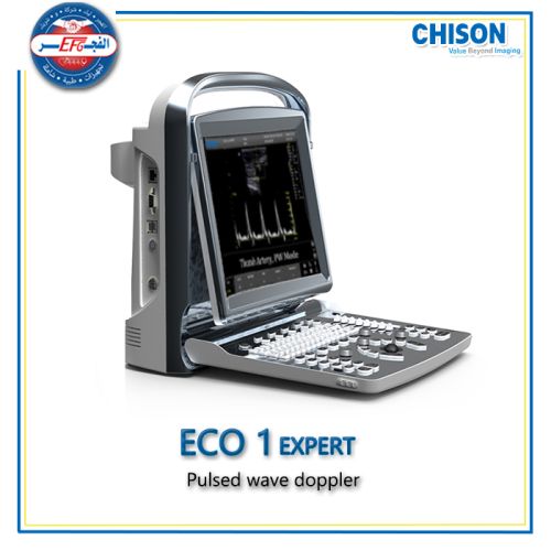 CHISON Ultrasound ECO 1 EXPERT with pulsed wave doppler B&W  جهاز سونار تشيزون إيكو1 إكسبيرت 